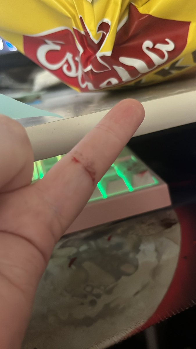 tristan_nyah's tweet photo. THE TIME I FINALLY WENT OUTSIDE I TRIED TO GRAB SOME PLANT IT GAVE ME A CUNT ON MY PINKY DINGER OMFG IT HURTS #nevergoingout #outside #unemployementrules #nooutside #betrayed https://t.co/94LCD1qFNE
