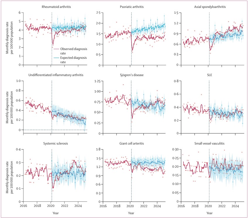 TheLancetRheum's tweet photo. NEW RESEARCH—Trends in autoimmune rheumatic disease diagnoses before and after the COVID-19 pandemic in England: a population-based cohort study using @OpenSAFELY https://t.co/HNcP8TtpIB

Plus linked Comment by @jeffsparks https://t.co/9OAwGysV0C https://t.co/obMg3OljLS