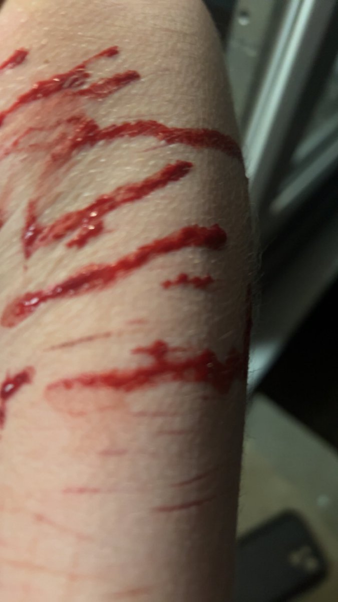 kadief7lp's tweet photo. SFXXXX FAKE MAKEUP FAKE BLOOD
#slittwt #shtwt #shedtwt #edtwt https://t.co/NS59uv2r9o