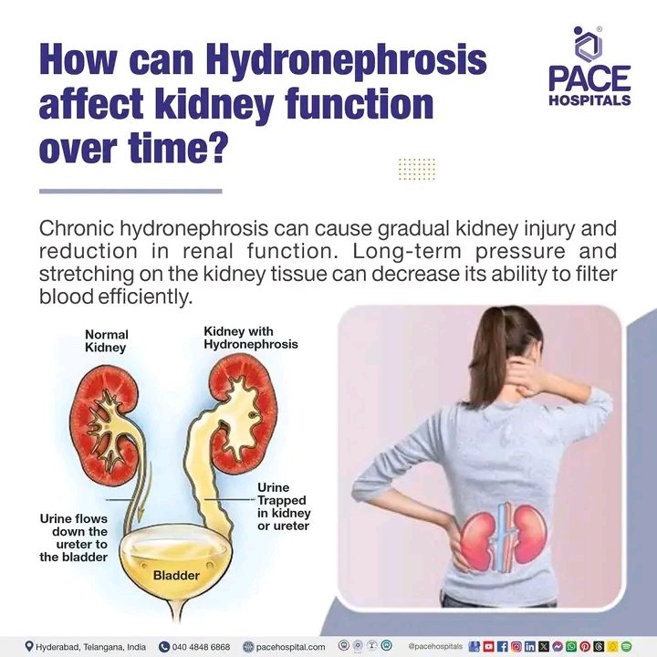 MAbdullah58266's tweet photo. @ajlkfad2333 Hydronephrosis: Dilated Pelvis and calyx https://t.co/zeBIzB3iRF