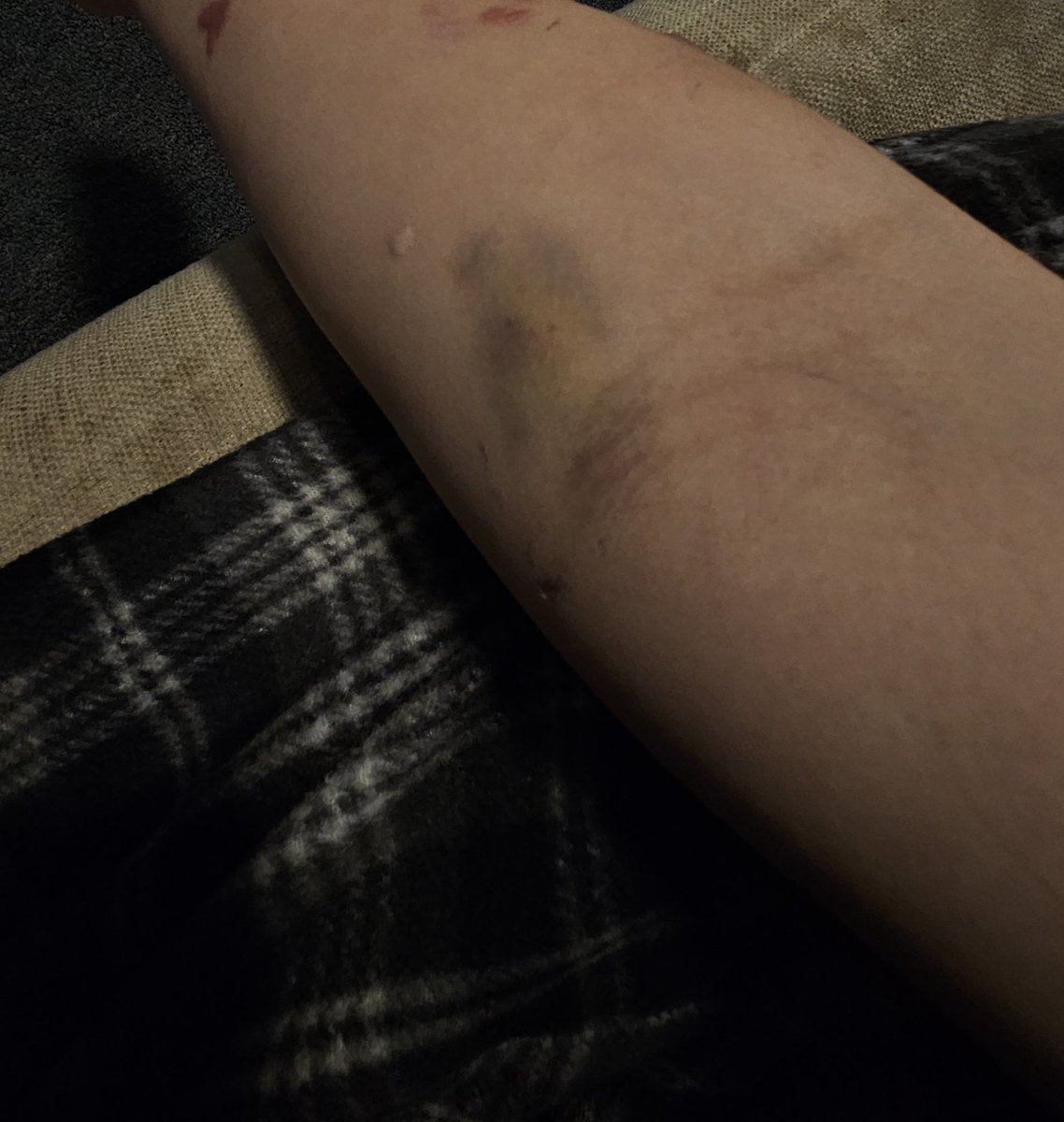 plushcope's tweet photo. i hate IVsssss https://t.co/T3m2SLdObM