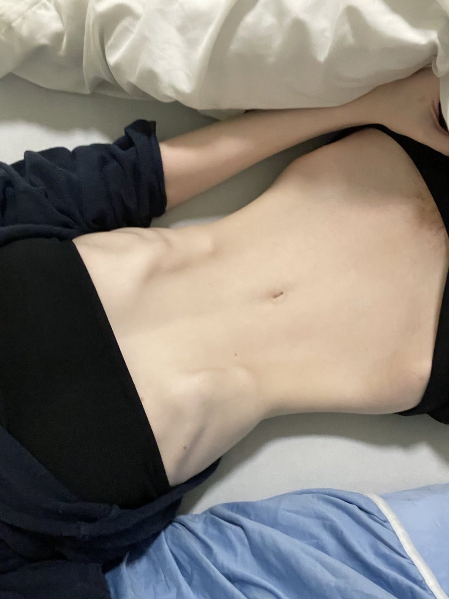 blvebel1's tweet photo. ⋆. 𐙚 ˚❀⋆.ೃ࿔*:･
Moot hunt!!! Day 4 ꒰ #shedtwt #edrtwt #edtwt intro / moot hunt ꒱  

(Ana, ocd, anxiety, depression PANS, MCAS)

Intro ❤️:
Name: Leyley
Bm!: 11.7
Gw: 29 kg
Fav things to do: walk, MUSIC!!! And movies

────୨ৎ────

Racists, homophobes, transphobes DNI https://t.co/TsbO9mBmwm