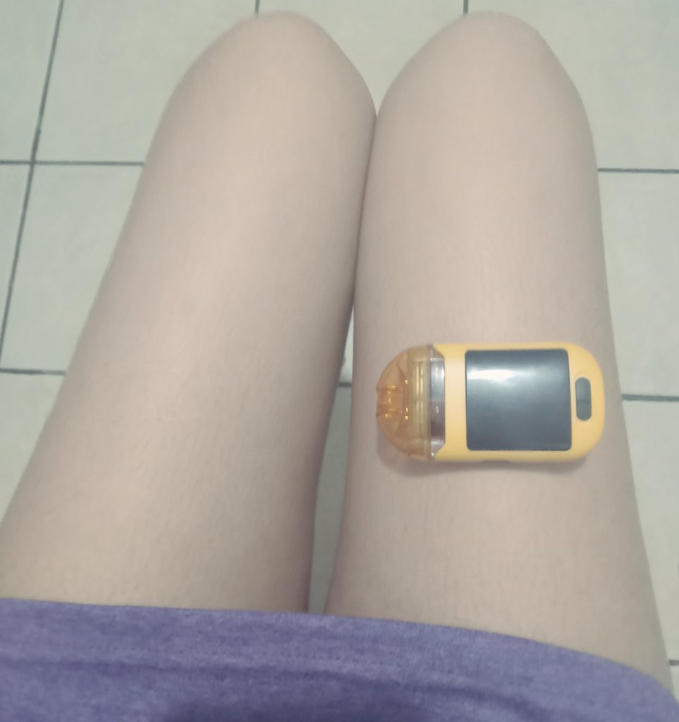 sprinklemadness's tweet photo. quick little body check (๑ᵔ⤙ᵔ๑) eventually my leg will be smaller trust https://t.co/q87IcSwbRP