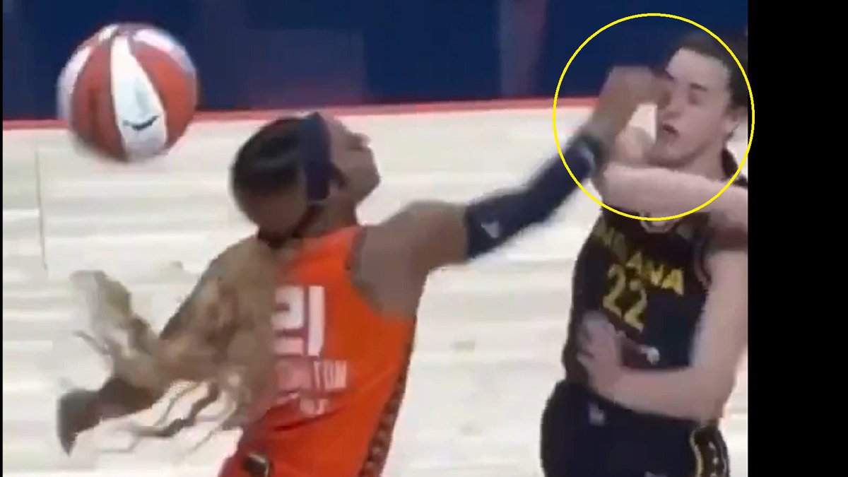 burackbobby_'s tweet photo. The Caitlin Clark drama has followed the same pattern for three years:
— black player hard fouls or cheap shots her.
— ESPN defends the dirty player, blames racism for the response.
— Clark’s fans criticize the dirty player.
— the media calls Clark’s fans racist.
— the dirty player claims she is being bullied online
— Clark is forced to stick up for the black player who tried hurting her.

Rinse and repeat.