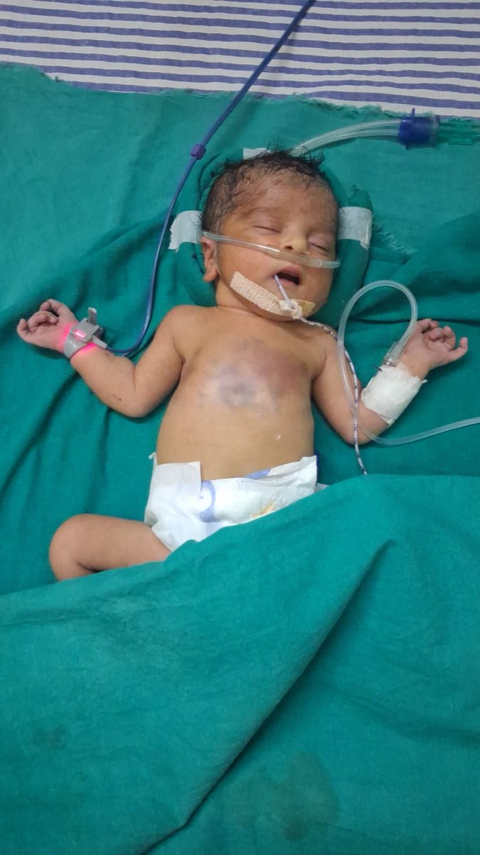 iamvershaverma's tweet photo. Hospital 
children medical Centre
Pana lala road daliganj lucknow 
डॉ.आशुतोष वर्मा 
6284839602

Attendence Name 
Satpal Singh 
6284 839602

Required A+ blood group for new born baby girl https://t.co/PBSxyJGrMO