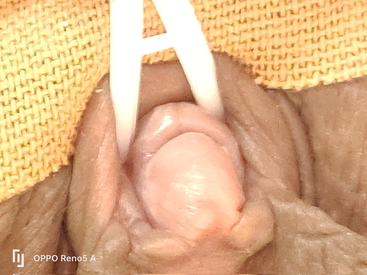 p_hreichan5's tweet photo. #clitoris #clitoris stimulation #clitoris binding #clitoris suction #clitoris torture #clitoris electric current #clitoris only #clitoris bdsm #clitoris bondage #clitoris acupuncture #clitoris needle #clit clothespins #Hard clitoral torture https://t.co/F7iroDxNZT
