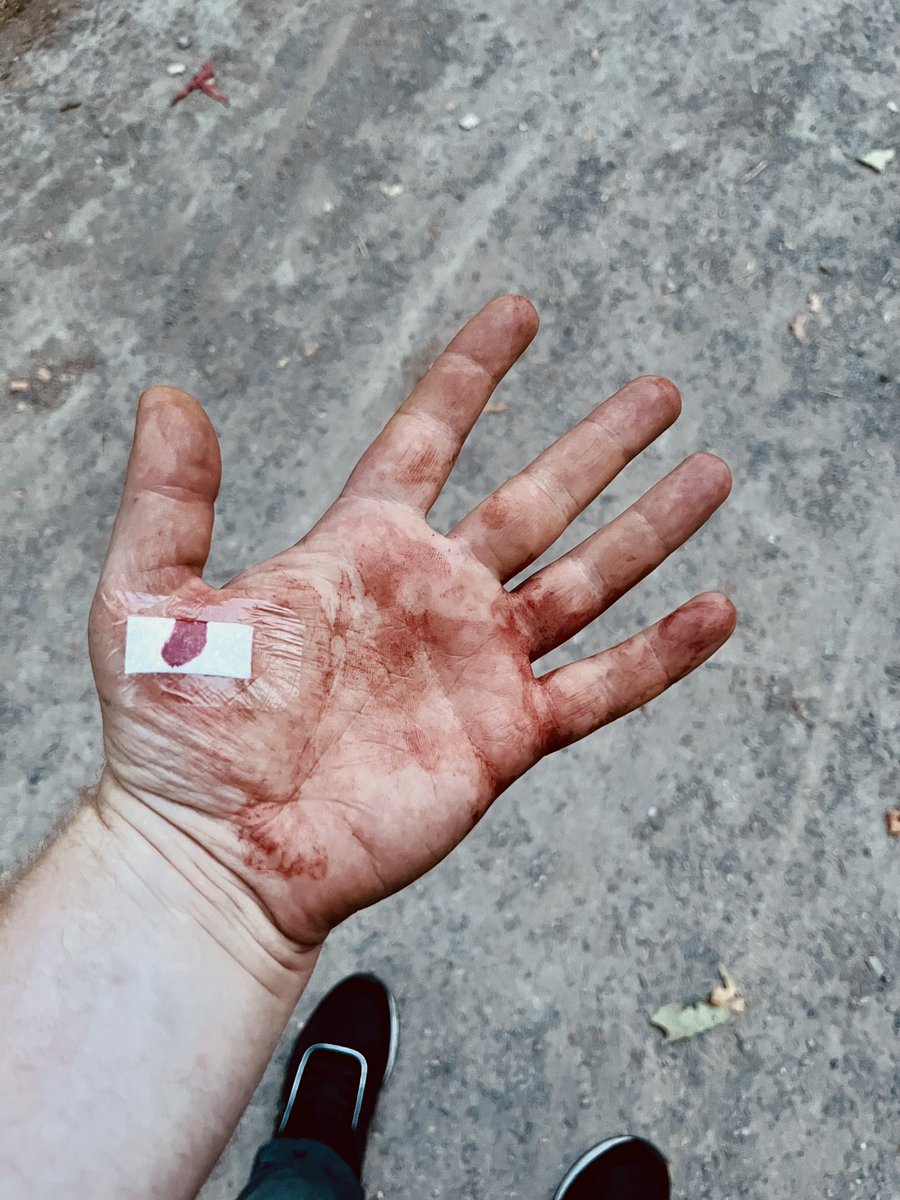 MiikeGyver93's tweet photo. Ich wollte doch nur ein lecker Bierchen trinken.

Hütet euch vor heimtückischen Splittern in 4/6-Packs.

Bier schmeckt trotzdem😄👍🏻 https://t.co/5lxah8pQ1e