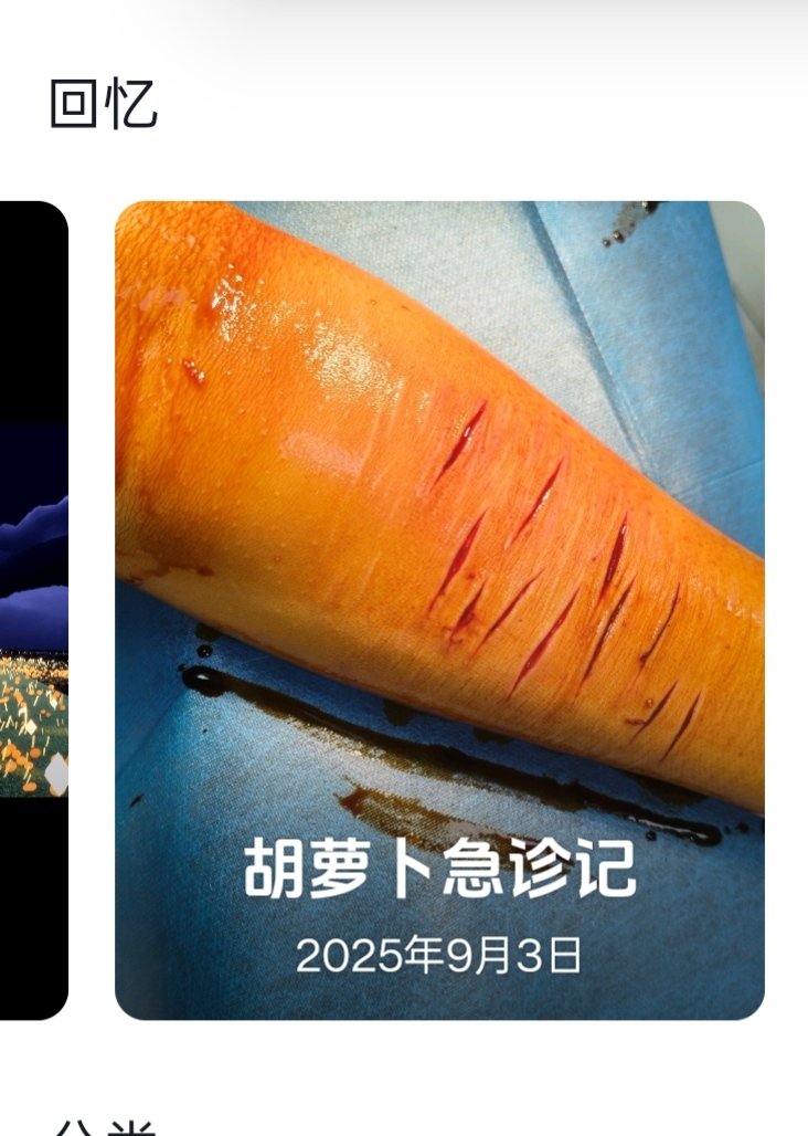 779xik9's tweet photo. 老子绷不住了 #自残
神TM的胡萝卜急诊 https://t.co/WEnu0U77u7