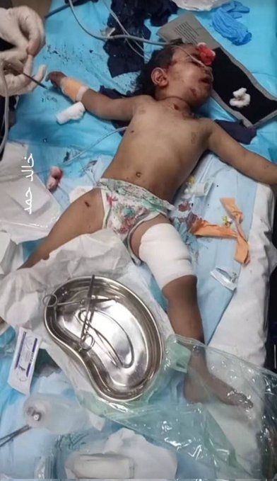 BusaidiNaser's tweet photo. طفل فلسطيني من ضحايا اليهودي الإرهابي الإسرائيلي القذر.. https://t.co/rUyFdBYOG6