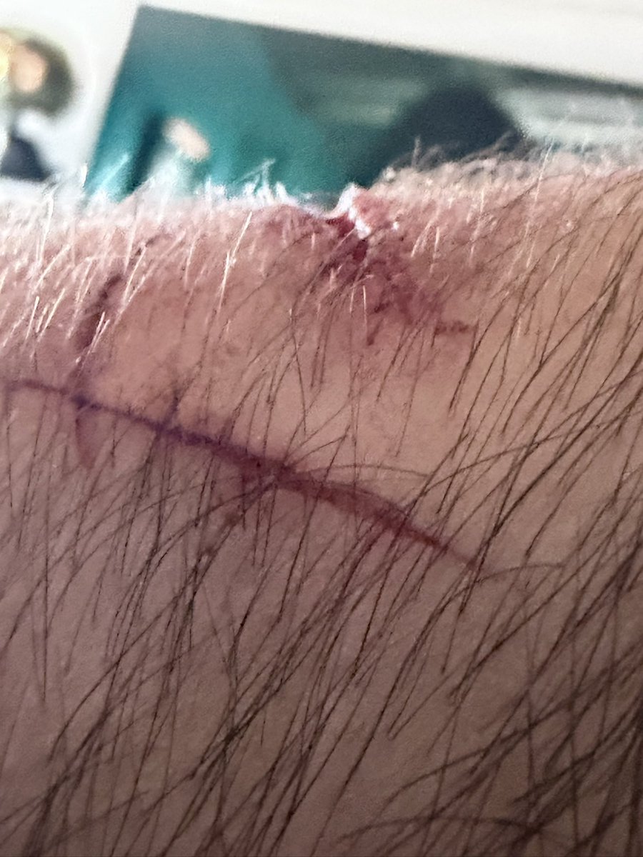 8Pickproofsnake's tweet photo. Un buen bache :) https://t.co/kchK6YlwQt
