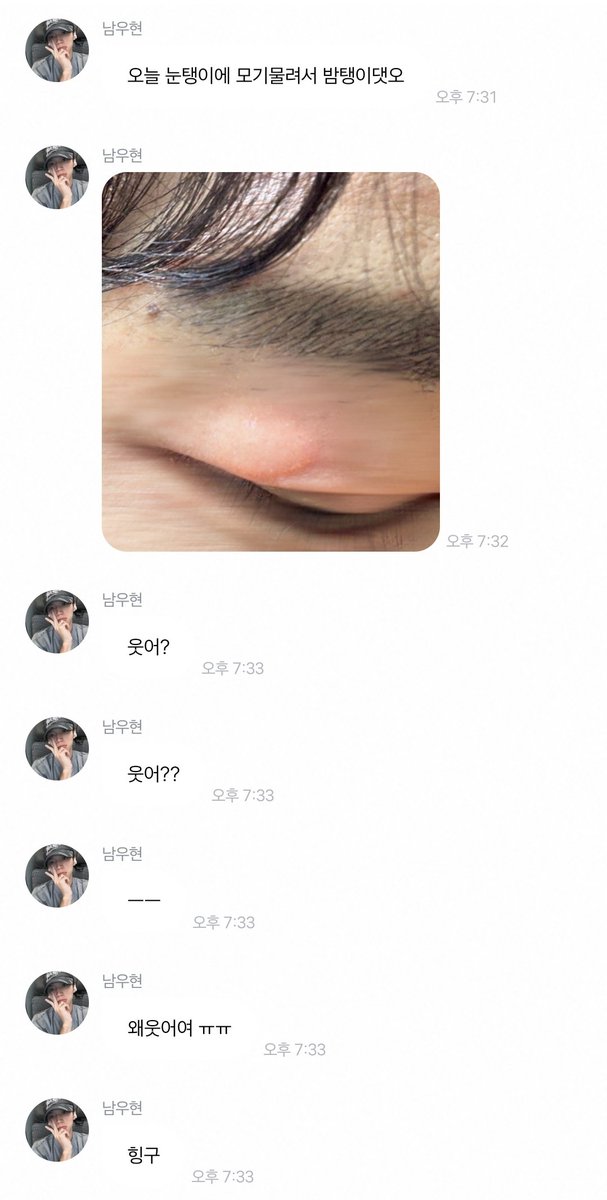 nwhjoa's tweet photo. 진짜웃기는견.. 저렇게모기가싫은데 모기한테 
눈탱이 맞았을때 얼마나 화나고슬펏을까? 
성동일아저씨만큼 웃음남 https://t.co/ulNKMgRZ9D