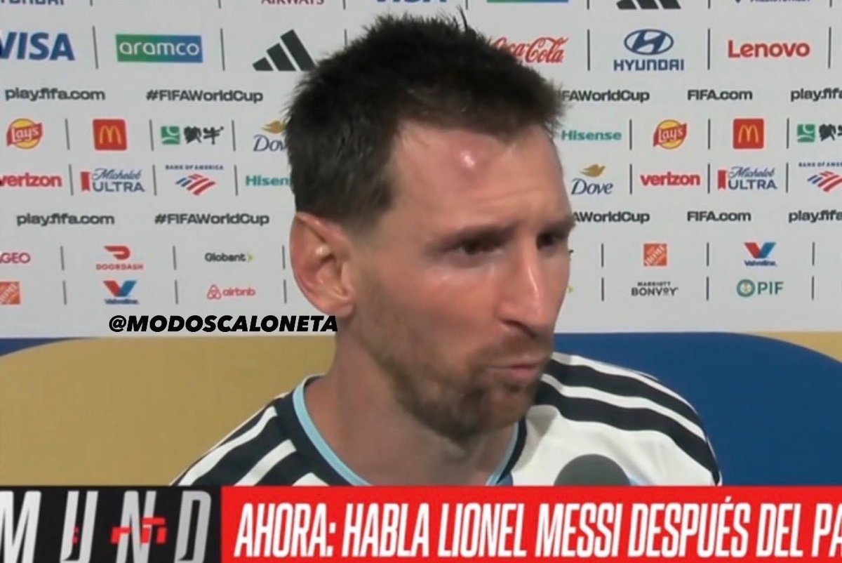 ejf249's tweet photo. messi terminó el partido con un chichón KJJJJ a los argentinos nos encanta sufrir somos literalmente UN TANGO https://t.co/XWoXrVf00I