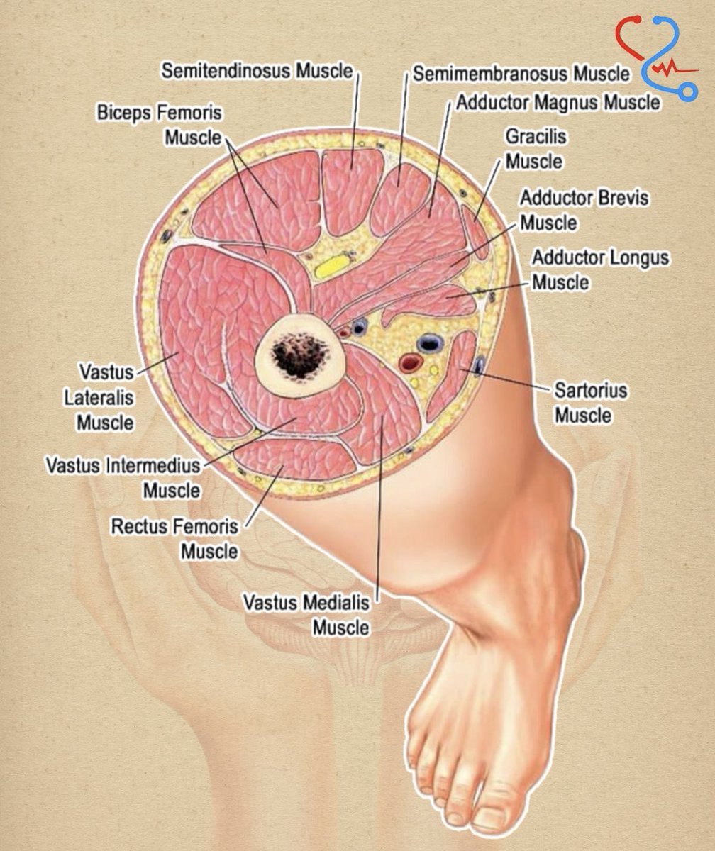 OGdukeneurosurg's tweet photo. Leg anatomy https://t.co/b76xV3nZ8s