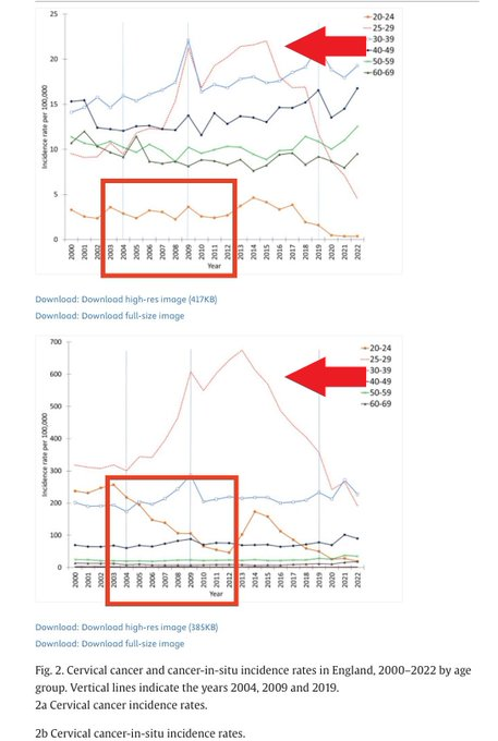 Jikkyleaks's tweet photo. Dear Jeff, although you imply that your article is an independent view it is completely undermined by the failure to include discussion of any of the following:

1⃣ Type shift - the fundamental problem with vaccinating against HPV types whilst failing to note overall HPV-related events (which increased in the older cohort). 
2⃣ Under 16 sexual/reproductive activity which fell off a cliff after 2007 (UK data) and almost certainly drove the drop in HPV infection in the under 25 cohort
3⃣ The increase in HPV-dependent disease in the catch up cohort that also received the HPV vaccine (UK data). 
4⃣ The massive change in screening programs that obfuscated any data in all countries adopting vaccination
5⃣ The fact that the FUTURE RCT studies on which the vaccines were approved are now 20 years old and never reported overall reduction in cervical cancers 
6⃣ The fact that the HPV-9 study showed no significant reduction in CIN3+ incidence (precursor to cervical cancer) in HPV-4 treated women.
7⃣ The massive conflicts of interest of the authors of the latest Lancet "study".
8⃣ Your quoting of the Palmer study shows your lack of understanding of clinical medicine. The claim of "no cervical cancers" was not only untrue but based on an cohort of only 34 girls followed up long enough to develop cervical cancer. 
9⃣ Failure to discuss NNV (number needed to vaccinate) in relation to NNH (number needed to harm).

Whilst your article contains some interesting commentary it doesn't add to the existing literature at all, as we know that most cervical cancers require HPV infection as causal. 

The question is whether the HPV vaccination actually prevents cancers or simply causes type shift - and what is the explanation for the increase in cervical cancers after the rollout in the catch up cohort. In addition we need to have transparent and real data to show that any deaths prevented by vaccination (if there any) are not offset by the known deaths and injuries from vaccination. If, as you state, massive studies would be  needed to show a single prevention of cancer then the risk of injury from the intervention can't be brushed under the carpet. 

Transparent data has not been forthcoming - like all vaccine data. 

What your article does do show however, by the huge list of omissions, your own bias in regards to vaccination data. 

Thread with links here:
https://t.co/CCRgKDLY05

@dystopian_DU @MaryanneDemasi @DrJulieSladden @SenatorAntic @missyTHX1138 @RWMaloneMD @PGtzsche1 @carlheneghan @AaronSiriSG @Fynnderella1 @DravenS17