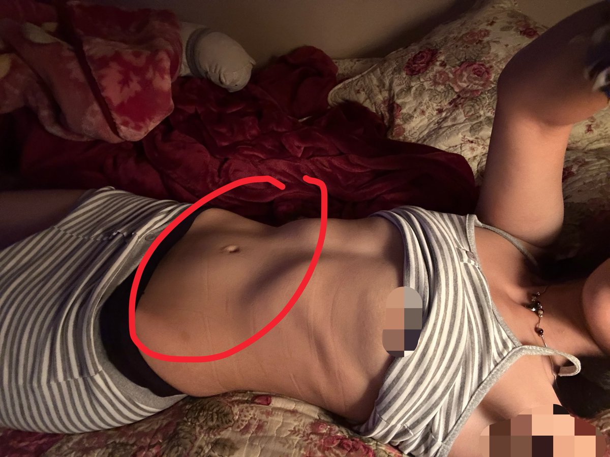 somirum's tweet photo. normal vs sucked in.. How to get rid of tummy fat? fml https://t.co/mmsAa7FQt0