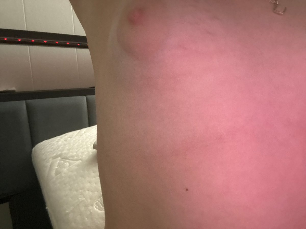 zoinbaseekitten's tweet photo. Kid boob 😳 https://t.co/ZB2SneUhAY