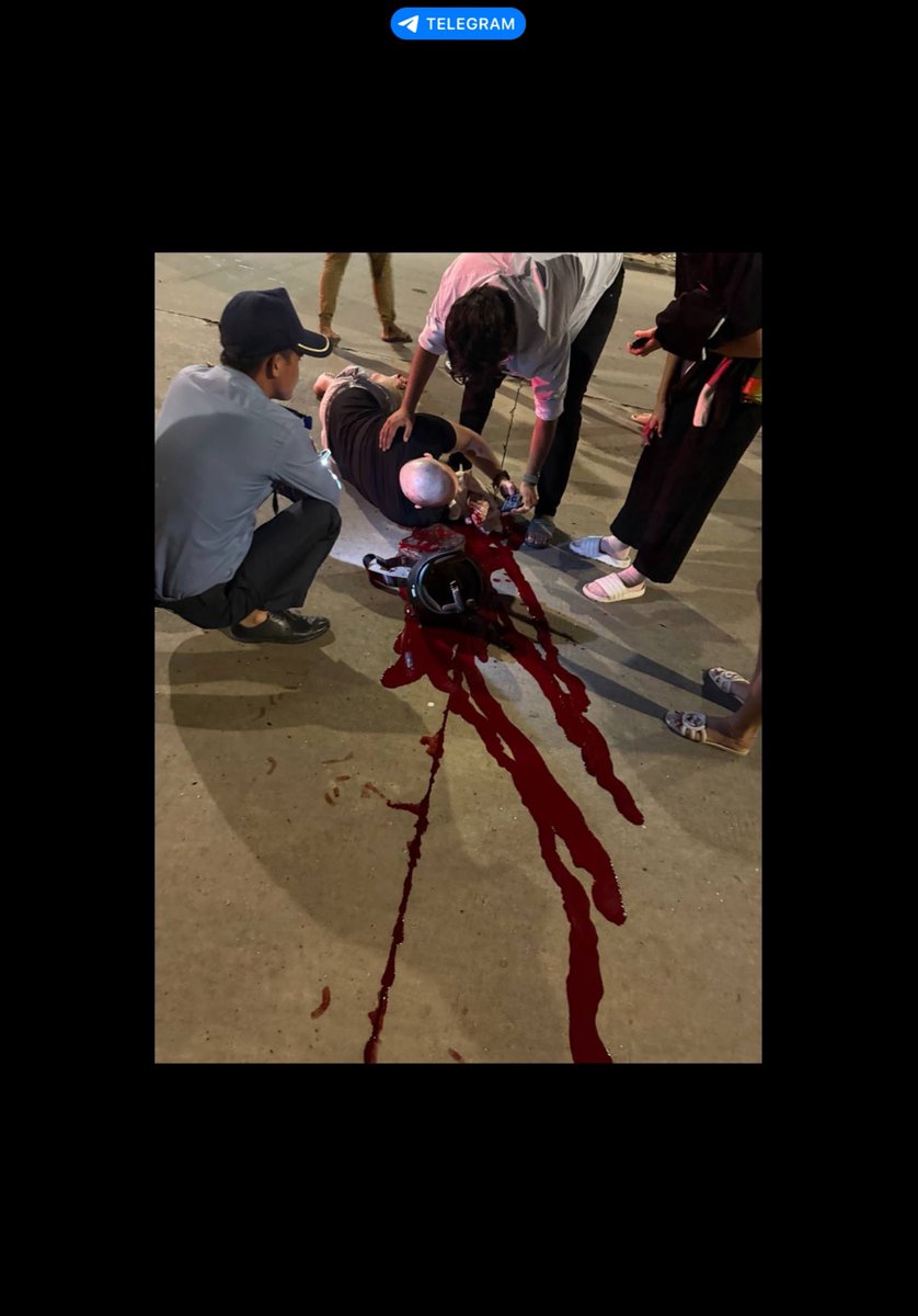 BossDogNFT1's tweet photo. @blknoiz06 #ANSEM Bro please change my life with an airdrop so I can get ACL surgery in Cambodia I’ll send you proof this is really me, I had a terrible motorbike accident. 

Fr3LPsrsiFNmuPNboyZ1tkWv7Rew2V2ymCY3FyD5cVH1 https://t.co/fSMgRzjawV