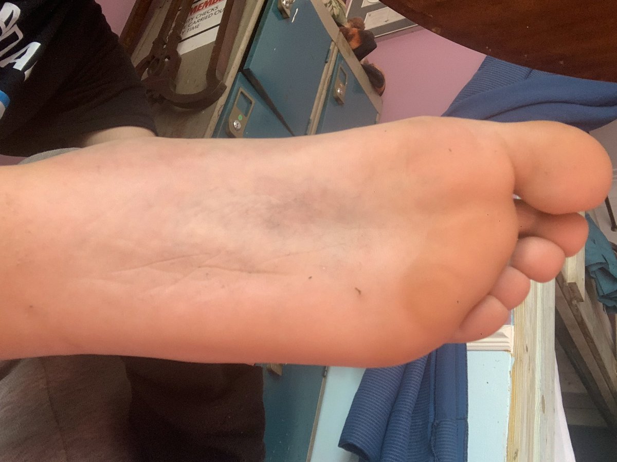 mrf1nd0m's tweet photo. Soles Saturday 

#feetfetısh #feetworshi̇p #feetcumtribute #feetِ #footfetısh #footworship #soles #solesandtoes #toes #master #alpha #findom #findoms #findompaypigs #paypiggy #humiliation #degrading #walletdrainer #humanatm #cashcow #cashdom #domme #sub https://t.co/W4s9AEQE6b