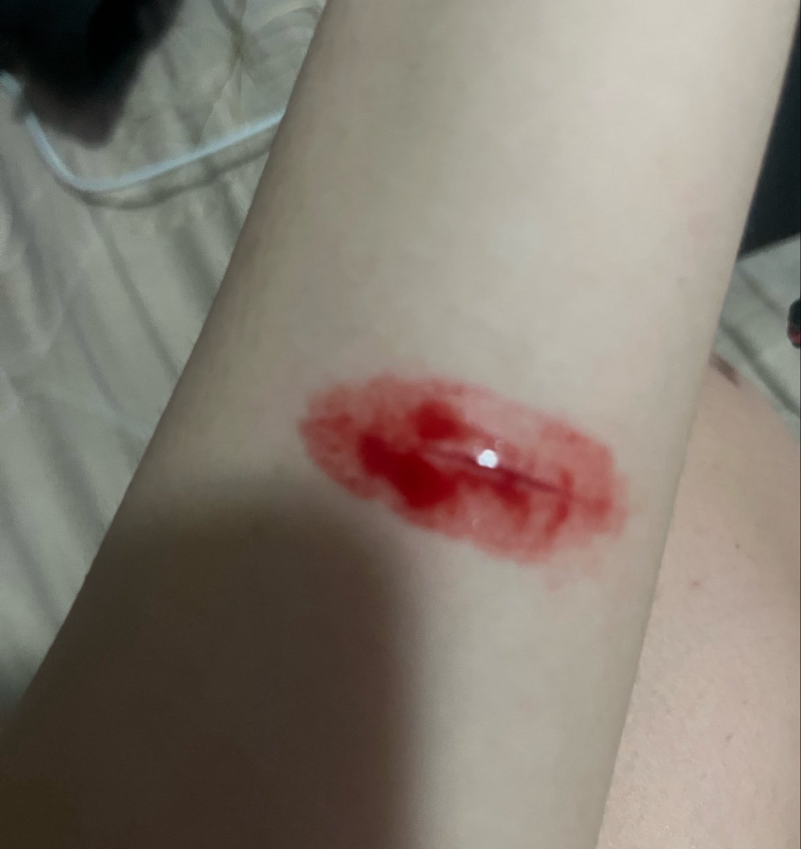 FutwSht's tweet photo. Me corte y la sangre agarró una forma extraña 

#shtwt #suicidetwt https://t.co/Smj05B7ADf