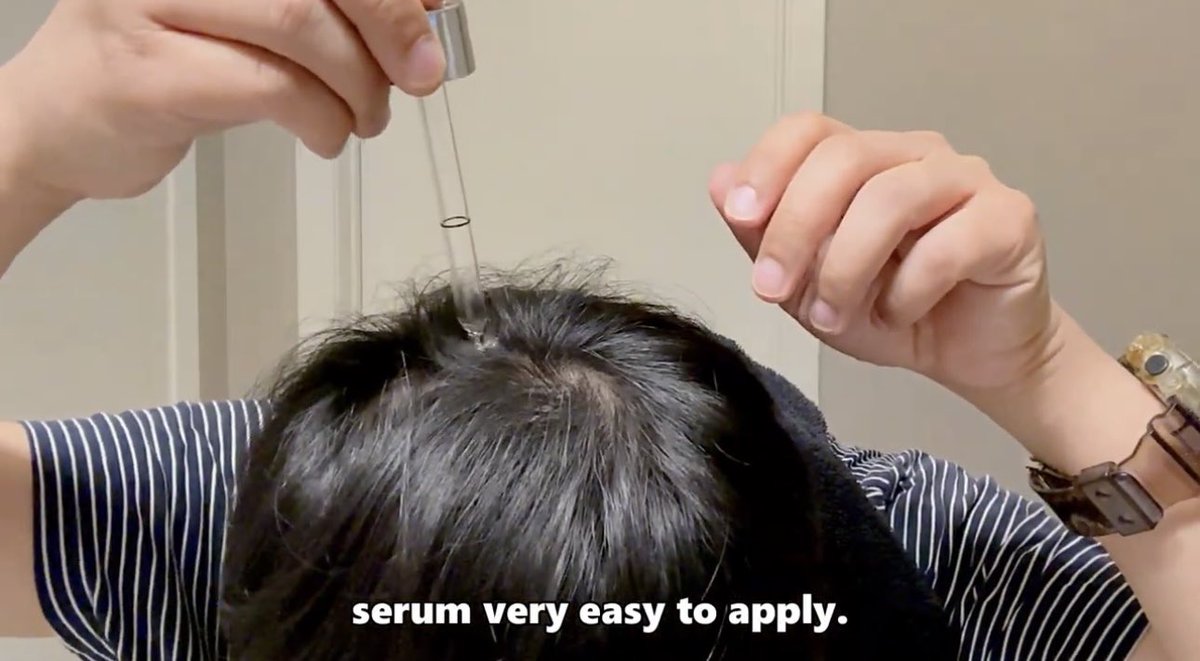 MarvinAlcaide's tweet photo. Behind the scenes: I put Aminexil 1.5% to test for two months and used it conjunctively with Minoxidil and Finasteride and did it added any benefits? 
Watch the Full video ⬇️
https://t.co/C6grKFw3N9 https://t.co/o7HAcxATQv