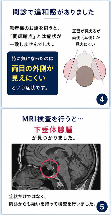 ymc3838's tweet photo. 閃輝暗点だと思ったら…
実は下垂体腺腫でした。

眼科では「異常なし」と言われた
20代男性の症例です　① https://t.co/AqQxmfHCHd