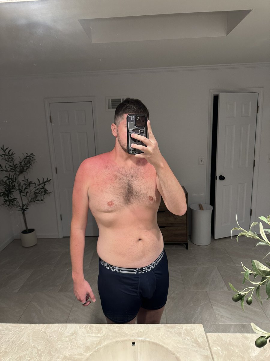 CowboyKs88498's tweet photo. Whoops I’m sunburnt already. Happy 4th😁 https://t.co/QZCaF0bv1u