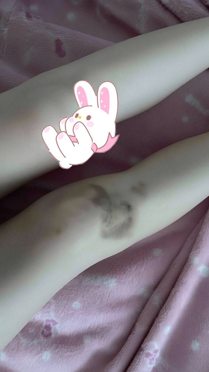 bunni 🧁 tweet media