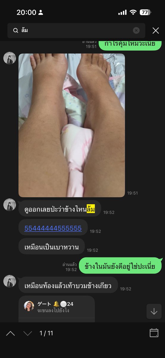 KetDring's tweet photo. แชทคนโกง (ชื่อซัน)                แอคบิบิลง 

@cutiebaeriebibi  คิดว่าโดนก็อปรูปเท้าตัวเองไหมคะ https://t.co/0a5E6MRrbh
