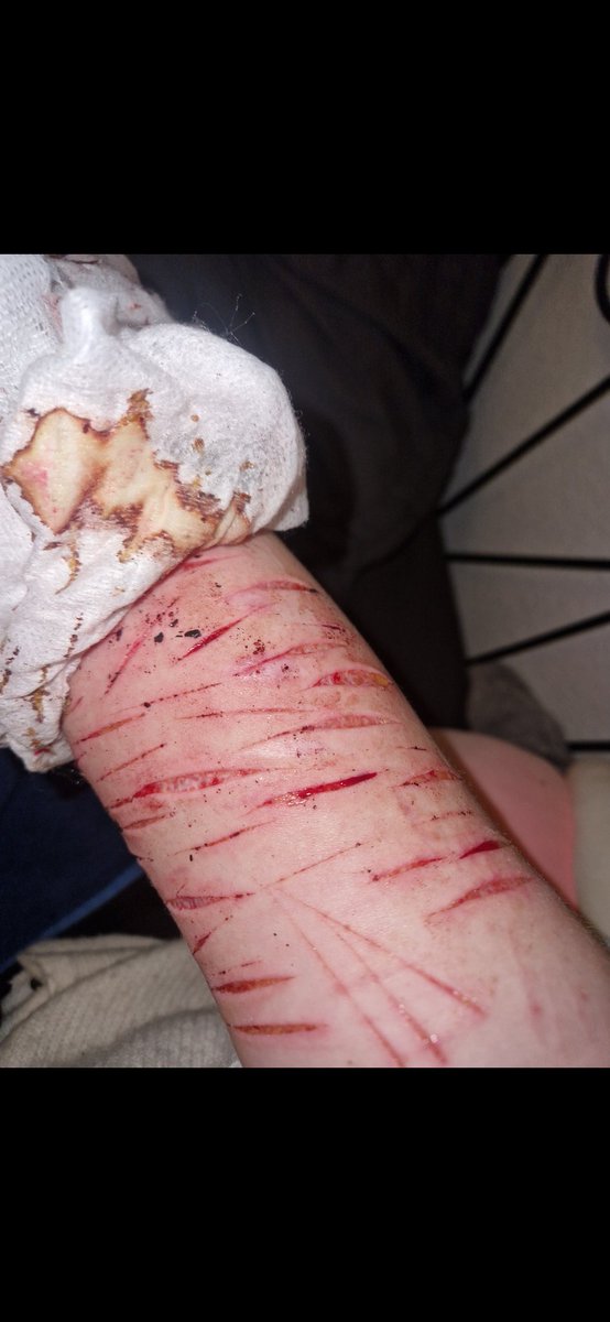 Marvi_00's tweet photo. Drunk cuts throwback 

#shtwt #edtwt #slittwt #sledtwt #shedtwt #drugtwt https://t.co/6ne3VfknXQ