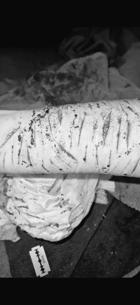 Marvi_00's tweet photo. Drunk cuts throwback 

#shtwt #edtwt #slittwt #sledtwt #shedtwt #drugtwt https://t.co/6ne3VfknXQ