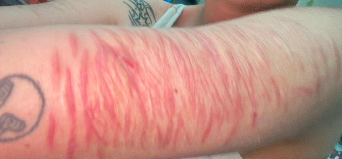 stayyawayy110's tweet photo. my HEALED SFX MAKEUP AI SCARS MOT EVEN REAL https://t.co/pVUVg7Vxny