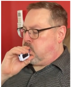 Cultination1's tweet photo. 🇨🇦🍺😵L'estomac de cet homme produit son propre ALCOOL, et il est ivre malgré lui depuis 10 ans.

Eric Poulin, un Canadien de Nouvelle-Écosse, souffre du syndrome d'auto-brasserie, une maladie très rare qui transforme les glucides en ALCOOL directement dans son intestin. Résultat, il peut présenter les symptômes d'une forte IVRESSE sans avoir consommé une seule goutte d'alcool.

Pendant des années, ses proches et plusieurs médecins ont cru qu'il buvait en secret. Aujourd'hui, il ne peut plus travailler à cause de cette maladie, tandis que sa femme se bat pour mieux faire connaître ce trouble encore très méconnu.
(CBC News)