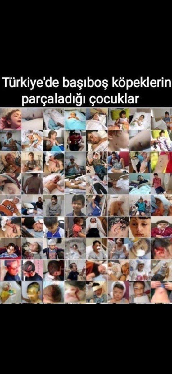 insanhaklarim's tweet photo. Kavramları Doğru Kullanalım
Her sahipsiz köpek sokakta olabilir; ancak sokaktaki her köpek sahipsiz değildir. Temel sorun, köpeğin sahipli veya sahipsiz olması değil, başıboş olmasıdır.
- Sahipli köpek: Bir sahibi bulunan köpektir.
- Sahipsiz köpek: Herhangi bir sahibi bulunmayan köpektir.
- Başıboş köpek: Sahipli ya da sahipsiz olmasına bakılmaksızın, denetimsiz şekilde kamusal alanda dolaşan köpektir.
- Sokak köpeği / sokak hayvanı: Hukuki ve teknik açıdan belirsiz, yanlış anlamalara yol açabilen ifadelerdir.
Bu nedenle, "sahipsiz sokak hayvanı" yerine "başıboş köpek", sahip sahibi bulunmayan durumlarda ise "sahipsiz başıboş köpek" ifadesinin kullanılması daha doğru ve açıklayıcıdır. Çünkü kamu güvenliği ve hayvan refahı açısından asıl sorun, köpeğin sahipsiz olması değil, başıboş bırakılmasıdır.
#BaşıboşKöpekSorunu #StrayDogProblem