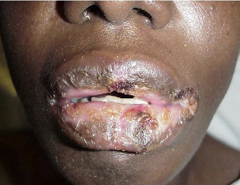 naijaratee's tweet photo. You get ₦1 million for every minute you kiss on the mouth.
How many minutes are you lasting? 👀 https://t.co/NLvR4gnj8Q
