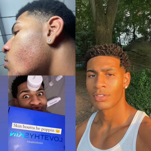 _MarcusAndre_'s tweet photo. Want flawless skin?? Support my business everything  is 50% Off today 🫶🏽

https://t.co/fLWDP47GT9 https://t.co/Rly8DX2Rmv