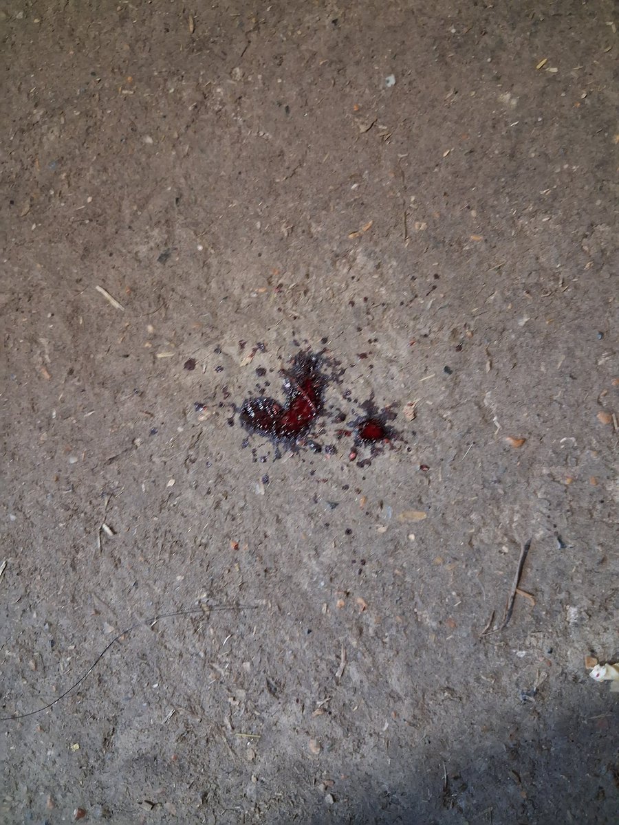 UreaBuildup's tweet photo. My nosebleed made a heart isn't that cute https://t.co/WJnxHZBWog