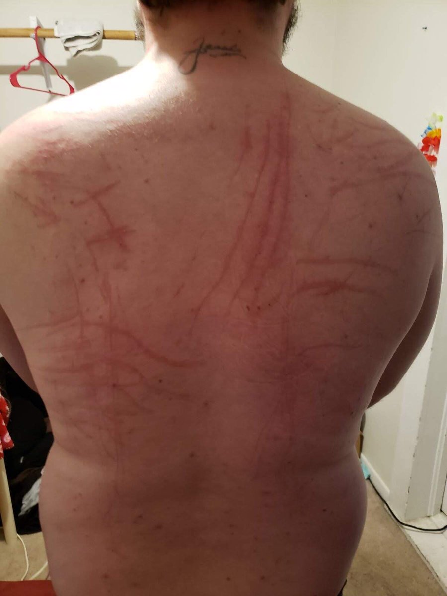 MMcfluffbut's tweet photo. It’s a old pic but god I love getting my back fucked up when I’m being called a good boy https://t.co/qinbUyOjby