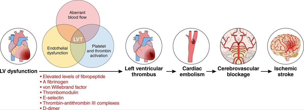 SeguraCardio's tweet photo. 📌Management of 👥 at Risk of Ischemic Stroke w/ Left Ventricular Systolic Dysfunction in the Absence of Intracardiac Thrombus

A Scientific 📝 from the @American_Heart 

#PositionPaper #Stroke #LVSD #HF https://t.co/EgJPurdKyO