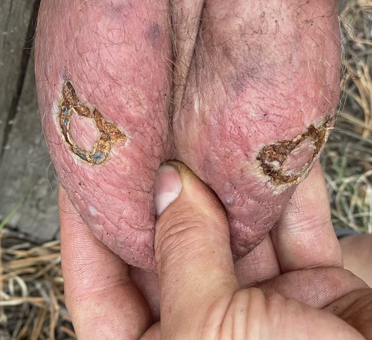 ObjectOfAgony's tweet photo. 😈: fggt flesh heals so well. Almost exact a year apart. 🖕😈🖕 https://t.co/VboCZIdaVH