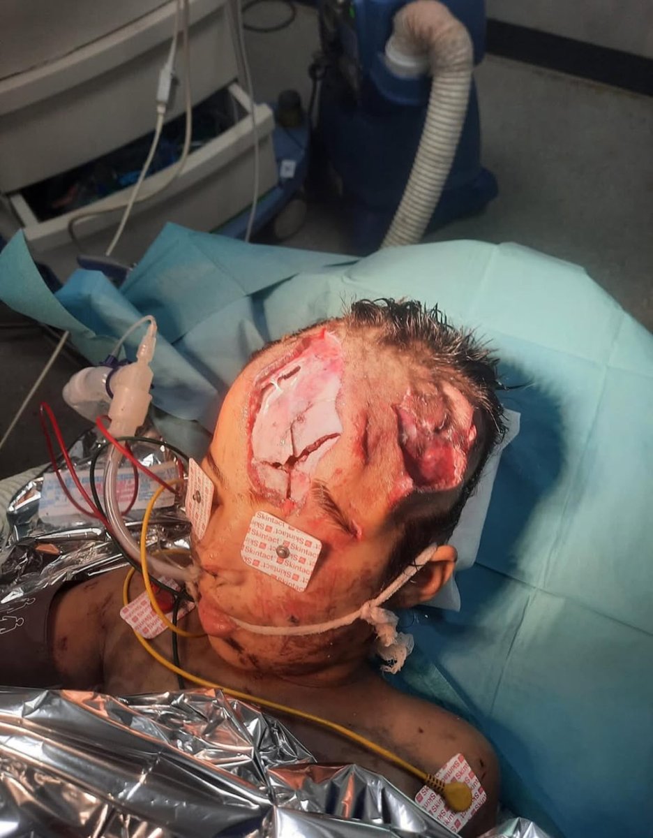 Jvnior's tweet photo. If Israel did this to your child, what would you do? https://t.co/PnKyARxfcq
