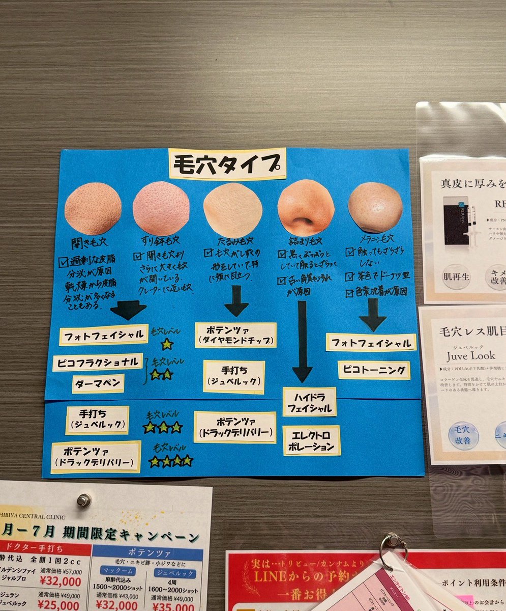 yuyudayo0924's tweet photo. よく行くクリニックに貼ってあったんだけどこれめっちゃわかりやすくない？私はすり鉢毛穴だから手打ちのジュベルックかポテンツァのドラックデリバリーすると目に見えて肌調子良くなるんだと思う
毛穴と一括りで考えないで毛穴開きの種類で施術決めると効果めっちゃ出る https://t.co/L1fbqiy7Du