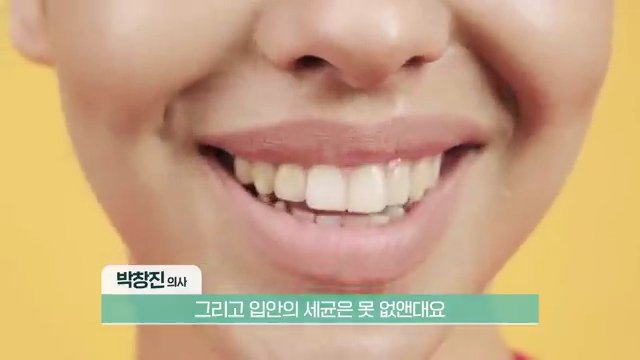 Alexlim1004's tweet photo. 🦷 양치할 때 '이것' 꼭 하세요! 
  1000만원 아낍!!!🦷 

30년 차 치과의사 박창진 원장님이 알려주는 내용인데, 이거 제대로 알면 치과 치료비 1000만 원은 가볍게 아낄 수 있겠더라고! !!!!

1.진짜 무서운 빌런은 '치주염' 

-나이 들어서 임플란트 세트로 하게 만드는 주범은 충치가 아니라 잇몸 뼈가 녹는 치주염이야. 

-양치를 아무리 열심히 해도 칫솔이 3주 동안 단 한 번도 안 닿은 사각지대부터 통증 없이 뼈가 녹아내리니까 조심해야 해. 

2.워터픽(물분사기)은 세차가 아니라 '물 뿌리기' 

-워터픽 하면 고춧가루나 음식 찌꺼기가 빠져서 시원하지? 근데 그건 눈에 보이는 덩어리만 뺀 거뿐이야 

-​차에 묻은 미끄덩한 세균막(바이오필름)은 솔질을 해야만 닦이듯이, 결국 진짜 치아 건강은 칫솔질로 세균막을 문질러서 벗겨내야만 지킬 수 있어. 

3.​입 냄새와 세균 잡는 치트키, '혀 클리너' 

-입안 세균이 가장 떼거리로 모여 사는 곳이 바로 혀야. 

-칫솔로 대충 닦지 말고, 끝에 날이 제대로 서 있는 플라스틱이나 쇠 소재의 혀 클리너로 슬슬 긁어줘봐. 세균도 엄청나게 줄고 입 냄새의 70~80%가 즉시 사라진대. 

4.가글과 소금 양치는 미신일 뿐 

-가글액이나 소금물은 끈적하게 붙은 세균막을 절대 파괴하지 못해. 오히려 가글은 입안의 유익균까지 싹 다 죽이고, 특히 알코올 든 가글은 입을 건조하게 만들어서 세균이 더 달라붙게 해. 

-소금으로 이 닦는 것도 치아랑 잇몸 다 상하게 하니까 절대 금지야. 

5.치약은 '불소' 성분 확인!!

-미백, 프라그, 잇몸 치약 같은 화려한 타이틀에 속지 마. 거품 잘 나고 화하게 뽀드득거리는 마트 치약들은 치아를 깎아내는 연마제가 너무 많이 들어있어. 

-치아 마모를 막고 시린 이를 예방하는 데는 오직 '불소' 성분이 많이 들어간 치약이 최고이자 전부야. 

​⚠️ 꼭 주의할 점! 

정확한 내 상태 진단이랑 구강 관리 상담은 꼭 전문 치과의사에게 직접 진료를 받고 진행해야 해! 아무 가글이나 치료제를 덜컥 쓰기 전에 의사쌤 처방을 따르는 게 안전하니까 명심하자.

너는 평소에 양치할 때 치간 칫솔이나 혀 클리너까지 꼭 챙겨서 쓰는 편이야?