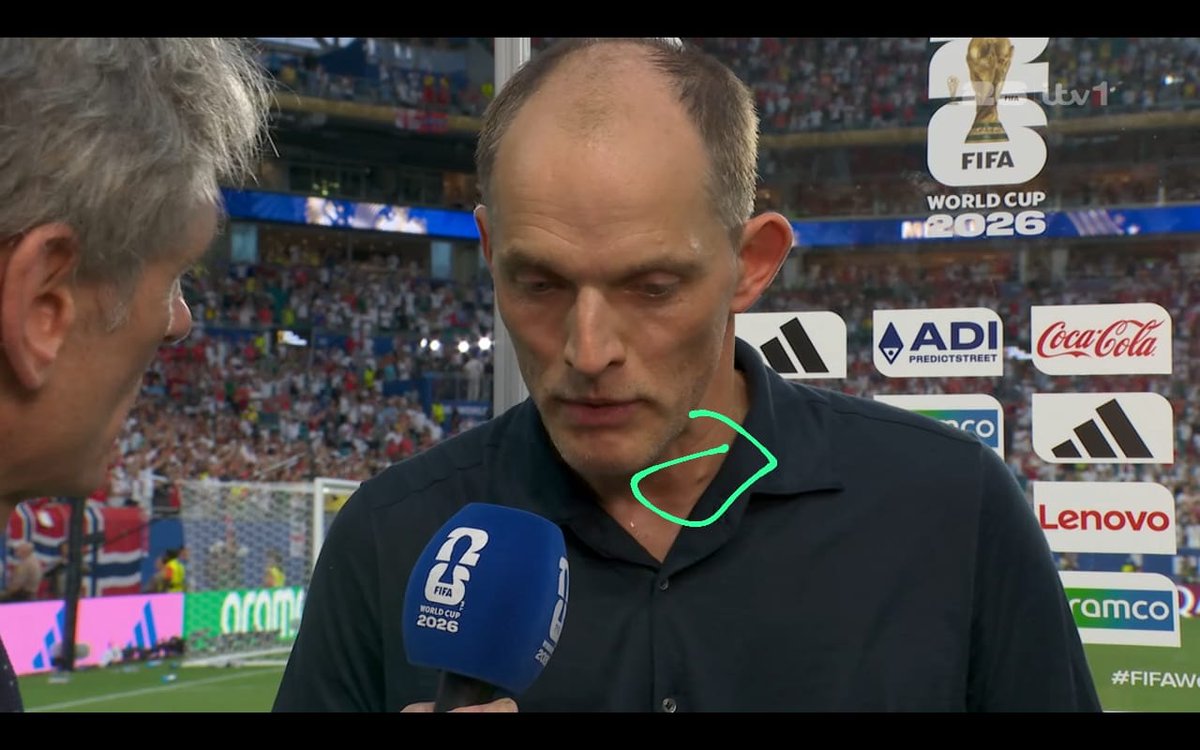 AsderHello's tweet photo. WAIT THOMAS TUCHEL HAS CANCER? https://t.co/iOhrHFAkCw
