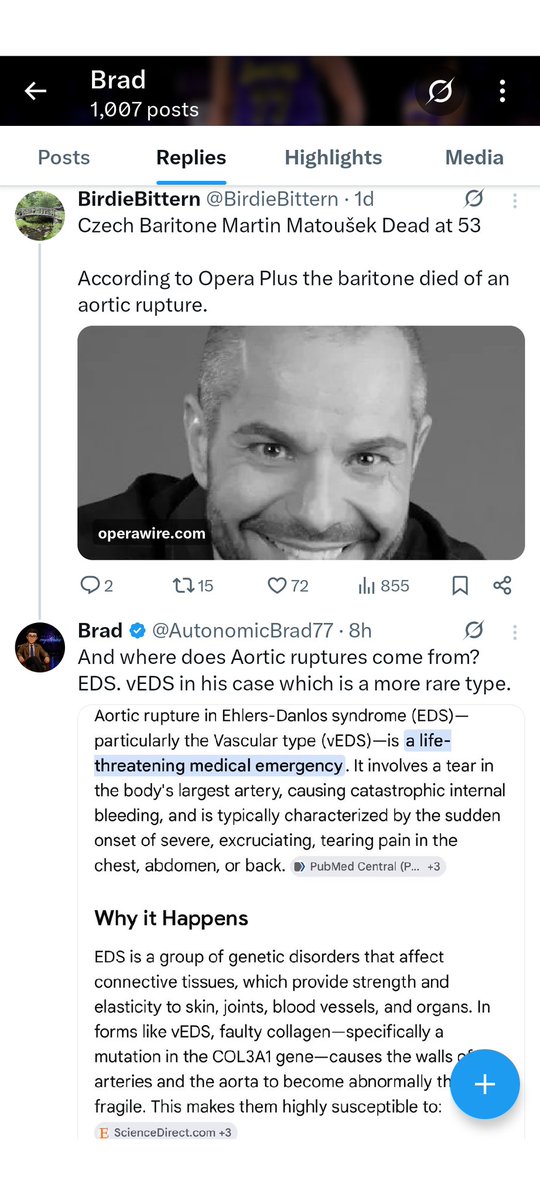 Autonomicbrad's tweet photo. Dr. Brad EDS warrior. Nothing gives me more pleasure than taking a rare form of EDS that affects roughly 1 in 50,000 to 250,000 people globally and making the aortic rupture this man died from, not about what actually happened, but about my obsession with EDS. #EDS #obsession https://t.co/apaZQTQcPy