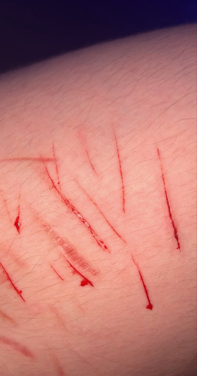 LEIGHCHARR's tweet photo. SFX
baby styro🥹 ignore how hairy my legs are fml https://t.co/oWiI56BG44