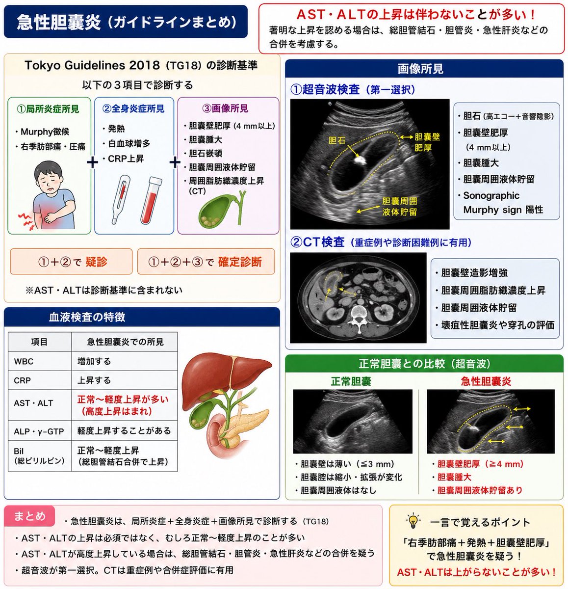 shiganai_naika's tweet photo. @tetchan_med_123 胆嚢は、肝臓の外にあるから
炎症が起きてもAST/ALTといった肝酵素
は基本上がらない

胆管炎は肝内胆管という言葉もあるように肝臓の中にも炎症が波及することがあるのでASTALTは上がる

医学生にはこのように説明することが多いです。正確な解釈とは異なるとは思いますが、ご参考までに🙇 https://t.co/UdSBfud7GO