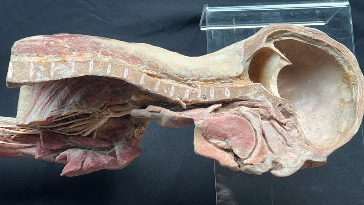 aimotolucretia's tweet photo. How you’re Made on the inside! And ops… I lost the brain, forgot it somewhere…!

OH NYOOOOOOOOOOOO

Anyway, look at that funny tongue! https://t.co/gJ0ecXlwMq
