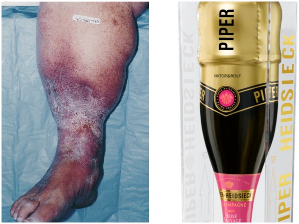 TrackYourHeart's tweet photo. The inverted champagne bottle appearance in the lower limb refers to: https://t.co/MePUF8zmVT
