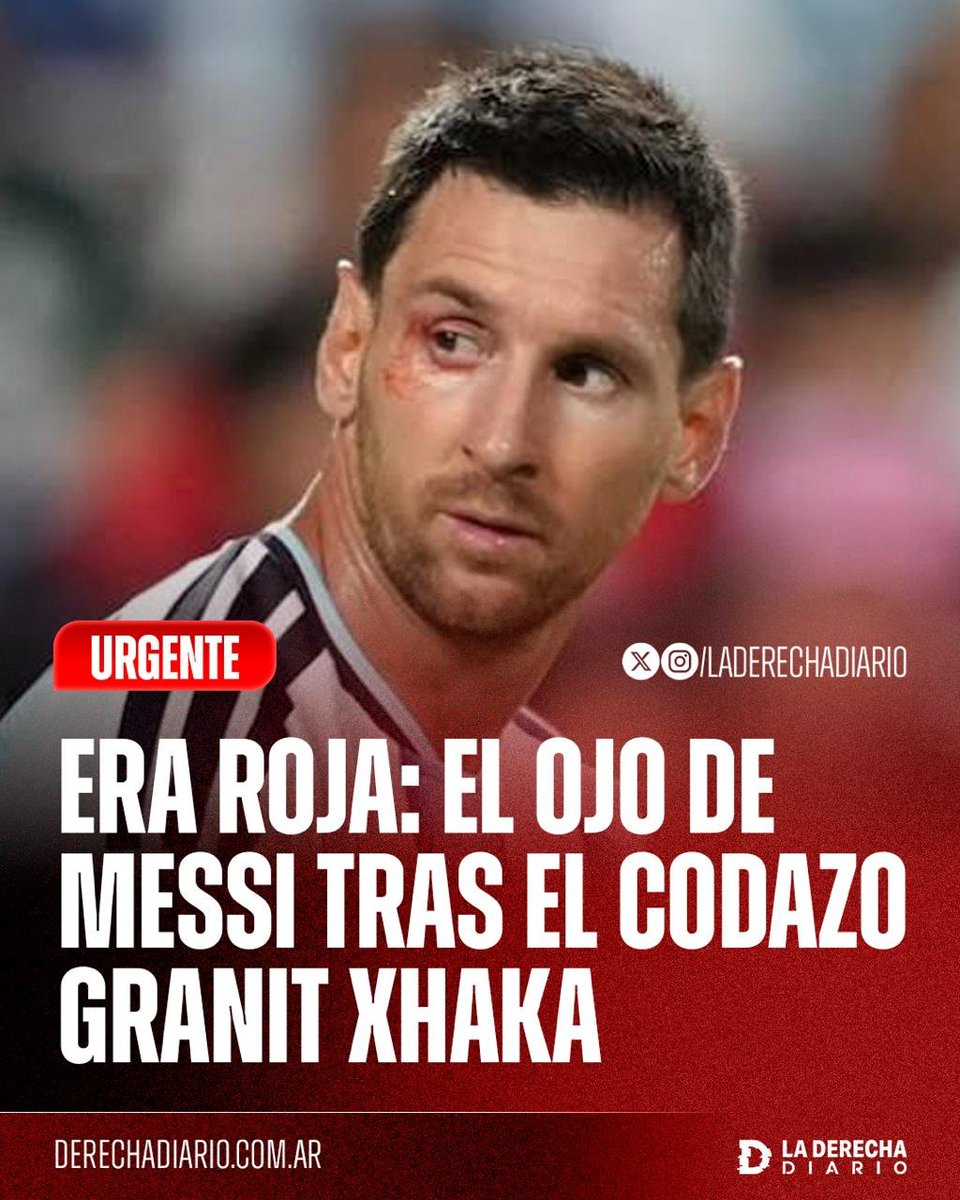 laderechadiario's tweet photo. 🚨🇦🇷🇨🇭 | ¡ERA ROJA! Lionel Messi terminó con el ojo ensangrentado tras recibir un codazo de Granit Xhaka, pero el árbitro no expulsó al capitán suizo y lo dejó seguir en cancha. https://t.co/H3dv1Ei8gu