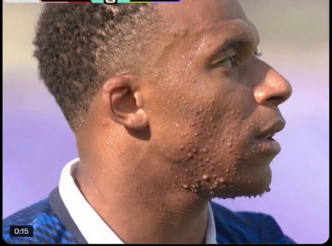 Gianferreyra_'s tweet photo. Escuchen, corran la bola

Juegan en Francia pero son todos de Angola

Que lindo es, van a correr, SON COMETRAVAS COMO EL PUT0 DE MBAPPÉ

Su vieja es nigeriana, su viejo camerunés, pero en el documento, nacionalidad francés https://t.co/OnL33IoVLl
